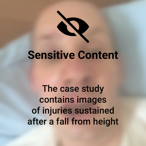 Prof-Peter-Brennan1 blurred